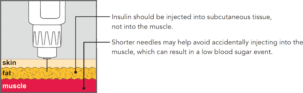 Schematic drawing showing a syringe with a short needle being injected through the top layer of skin into the middle layer of fat (‘subcutaneous fat’), without penetrating to the bottom layer, muscle.