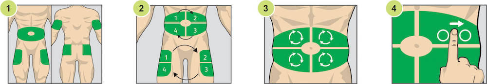 Schematic drawing with four panels showing how to choose an appropriate place on the body to inject insulin.