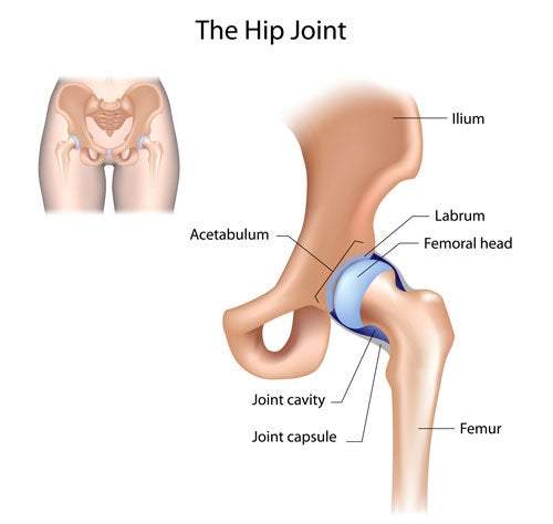 Gráfico de la articulación de la cadera