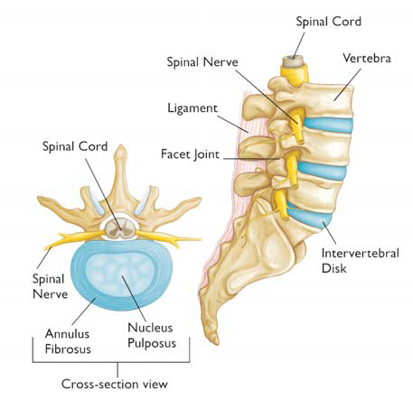 Is a Heating Pad Good for a Herniated Disc?