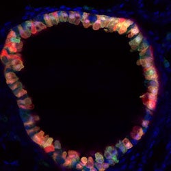 Mouse lung section with fluorescently labeled airway cells