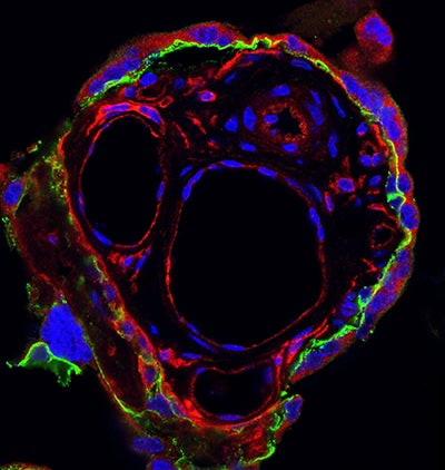 placental biology