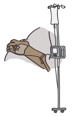 Drawing of a pregnant person's torso and arm, with arm attached to an IV