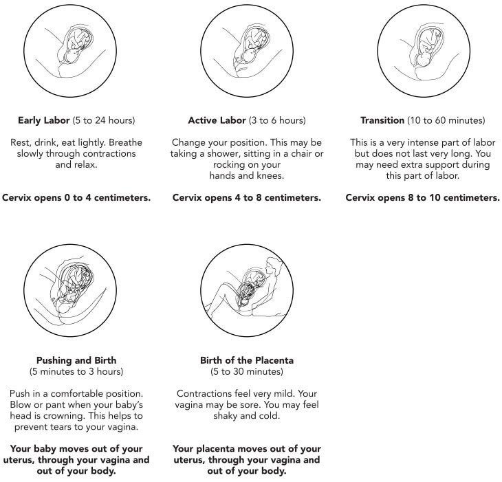 Illustration of the stages of labor