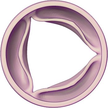 Aortic Valve - Healthy: Open